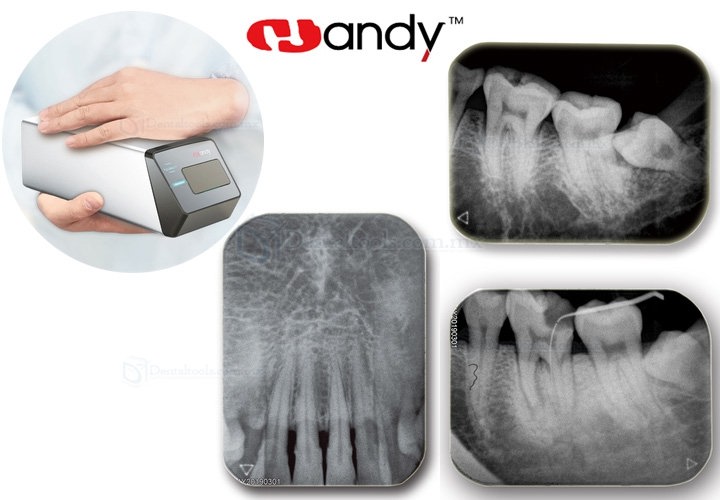 Handy HDS-500 Escaner Placas de Fósforo Panel detector plano intraoral para radiografía dental